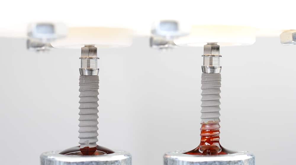 impaPrep Implantatsbehandlung