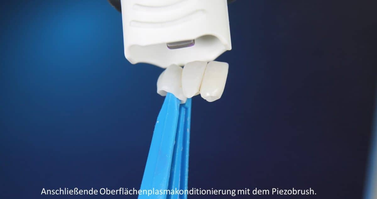 Plasmabehandlung mit dem piezobrush® PZ3