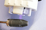 Plasma treatment of implants