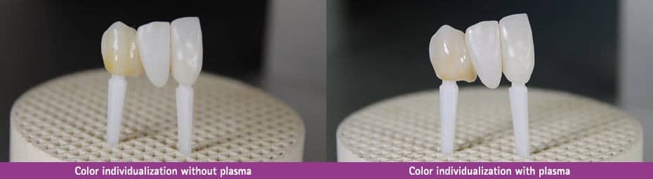Color individualisation of prosthetics without and with plasma treatment