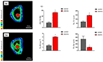 Effects of Plasma Treatment on the Bioactivity of Implants