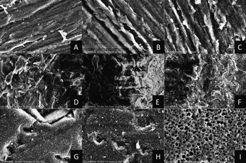 SEM images of PEEK after surface treatment